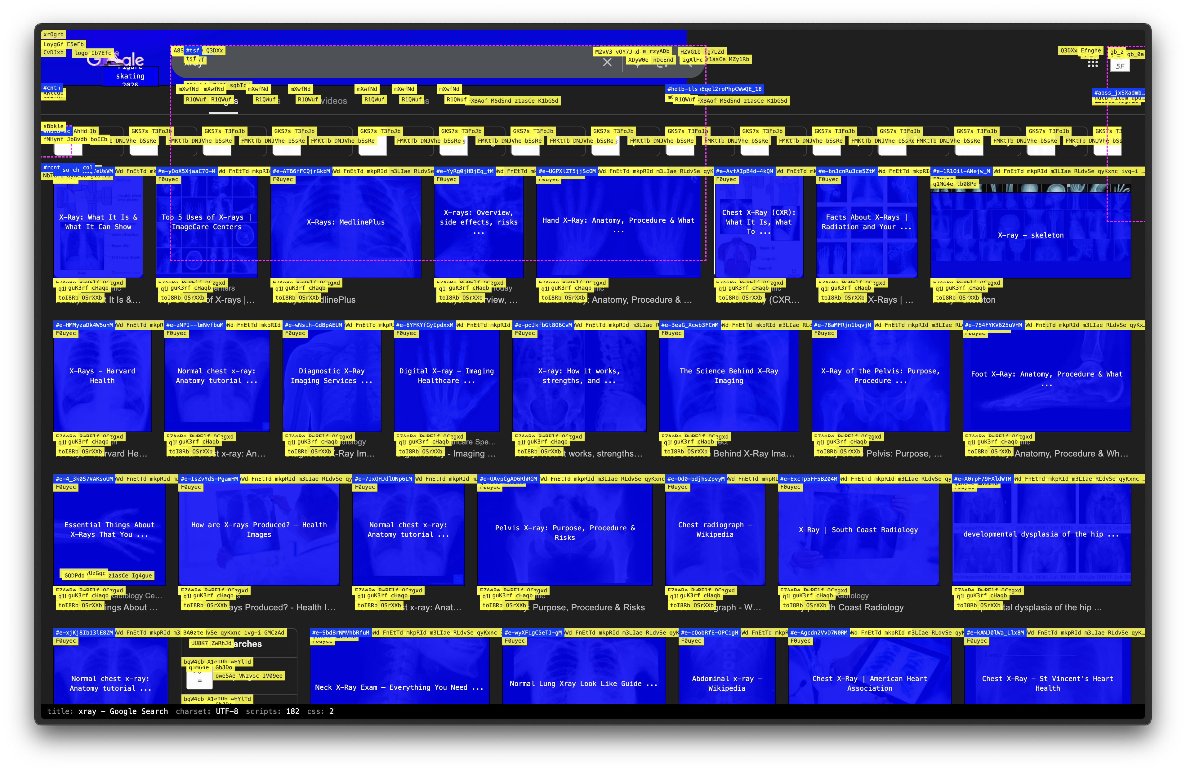 Webpage X-Ray